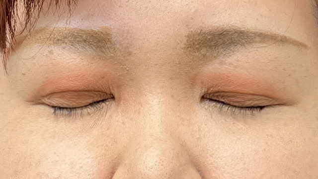 Postoperative Condition Part 1