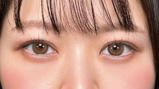 手术后的状态 其一