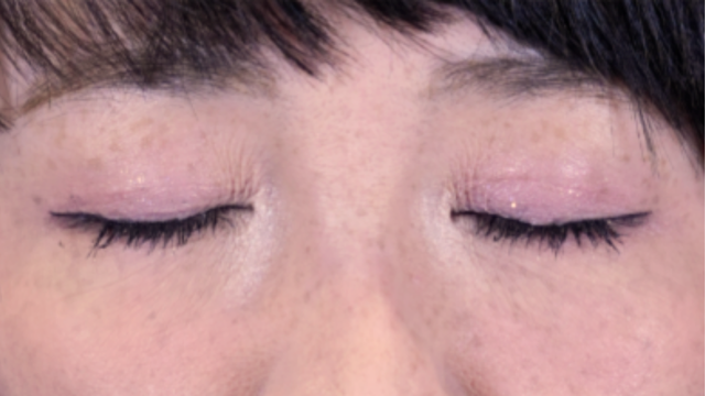 手术后的状态 其一