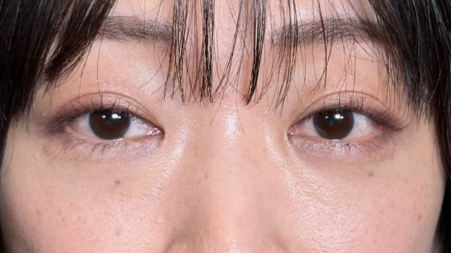 手术后的状态 其一