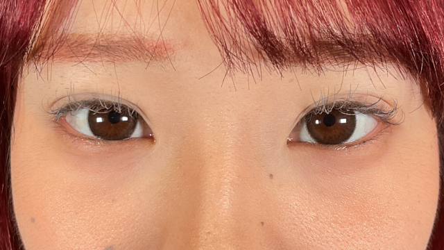 手术后的状态 其一