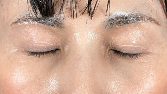 Postoperative Condition Part 1