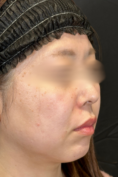 Postoperative Condition Part 1