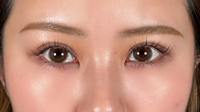 手术后的状态 其一