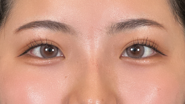 手术后的状态 其一