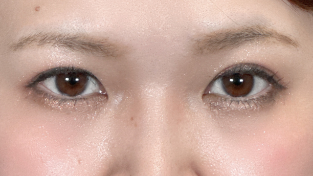 手术后的状态 其一