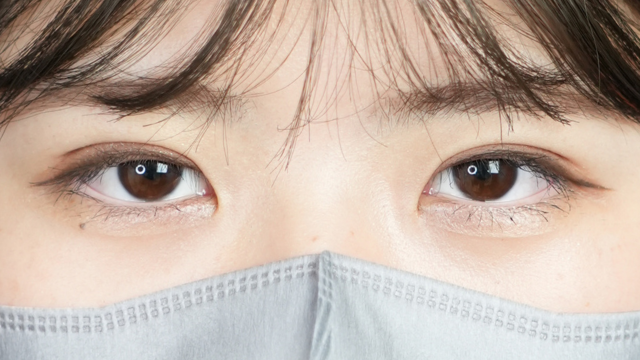 手术后的状态 其一