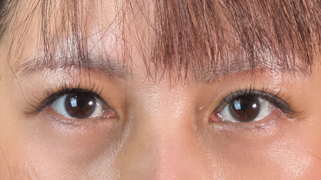 Postoperative Condition Part 1