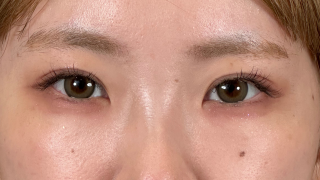 Postoperative Condition Part 1