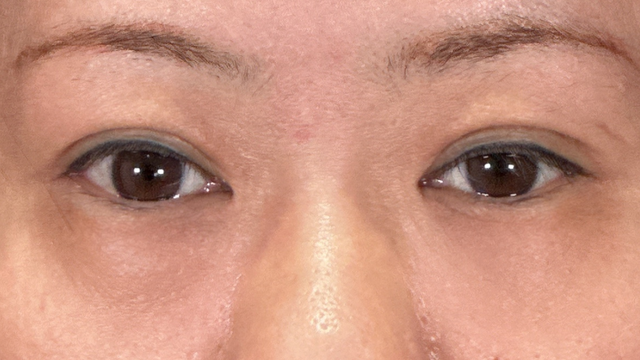 Postoperative Condition Part 1