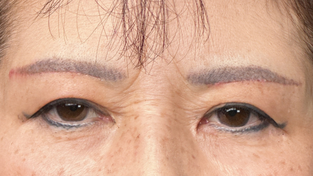 Postoperative Condition Part 1