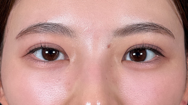 手术后的状态 其一