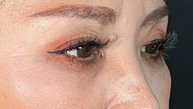 Postoperative Condition Part 1