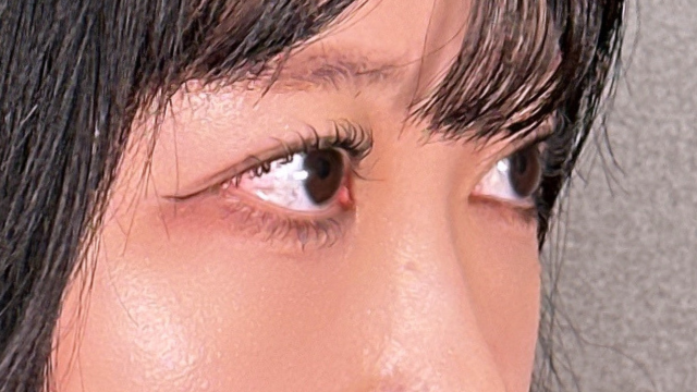 手术后的状态 其一