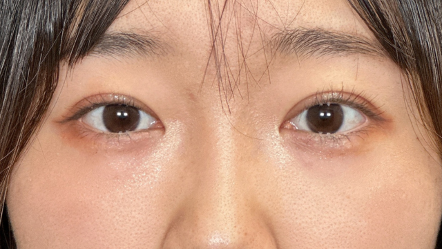 Postoperative Condition Part 1