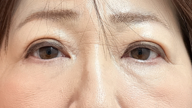 手术后的状态 其一