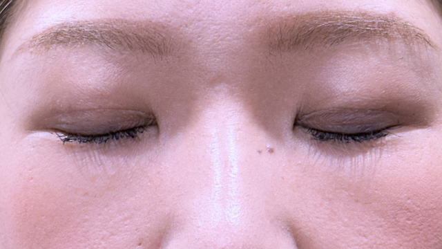 Postoperative Condition Part 1