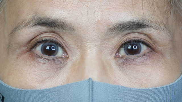 手术后的状态 其一