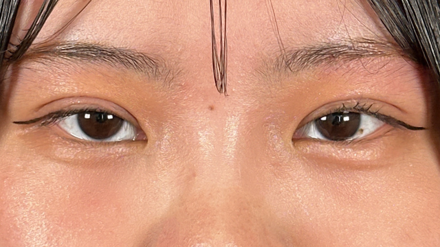 Postoperative Condition Part 1