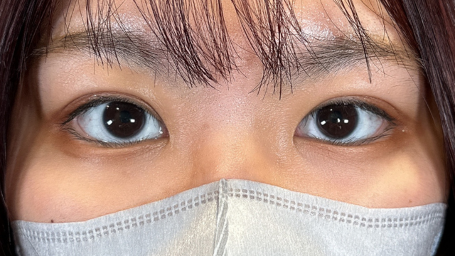 手术后的状态 其一