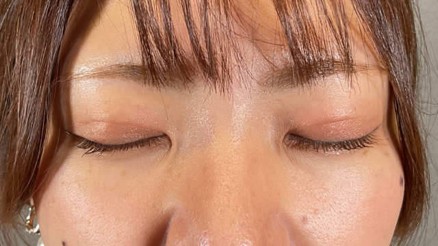 手术后的状态 其一