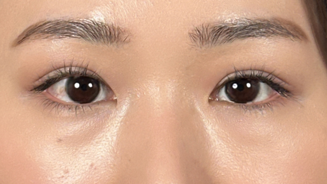 手术后的状态 其一