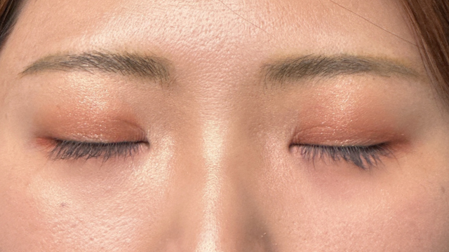 Postoperative Condition Part 1