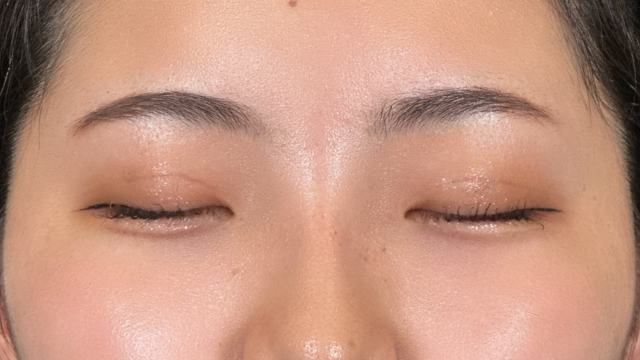 手术后的状态 其一