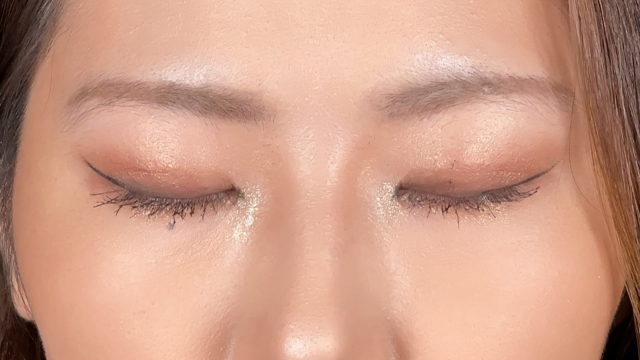 手术后的状态 其一