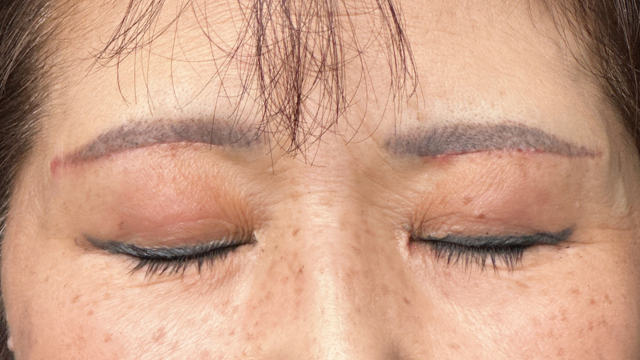 Postoperative Condition Part 1