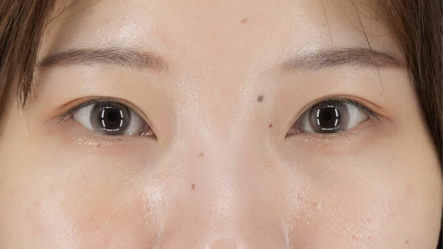 Postoperative Condition Part 1