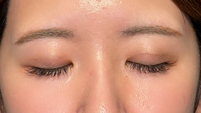 手术后的状态 其一