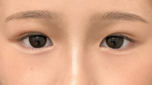 Postoperative Condition Part 1