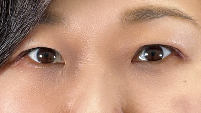 Postoperative Condition Part 1