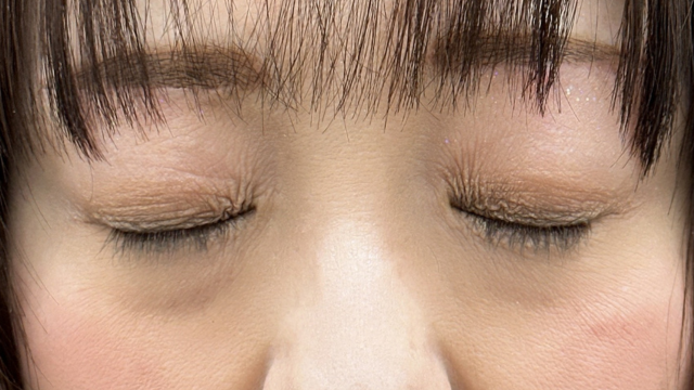 Postoperative Condition Part 1