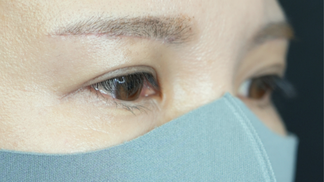 Postoperative Condition Part 1