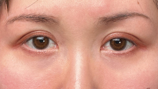 Postoperative Condition Part 1