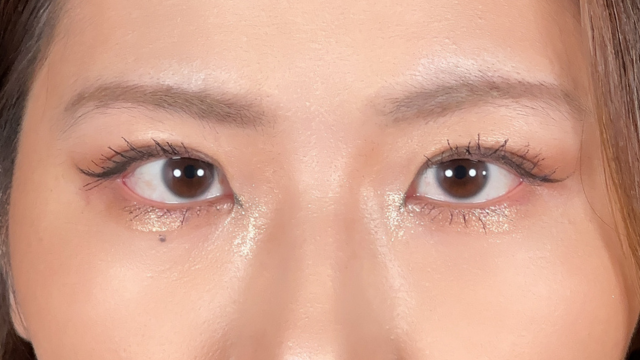 手术后的状态 其一