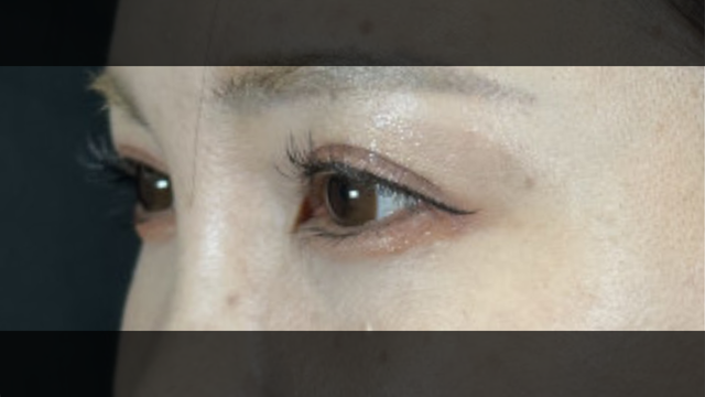 Postoperative Condition Part 1