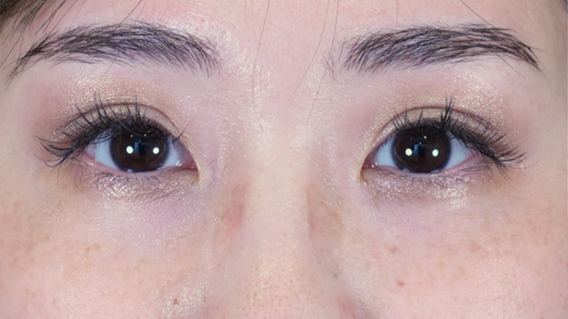 Postoperative Condition Part 1