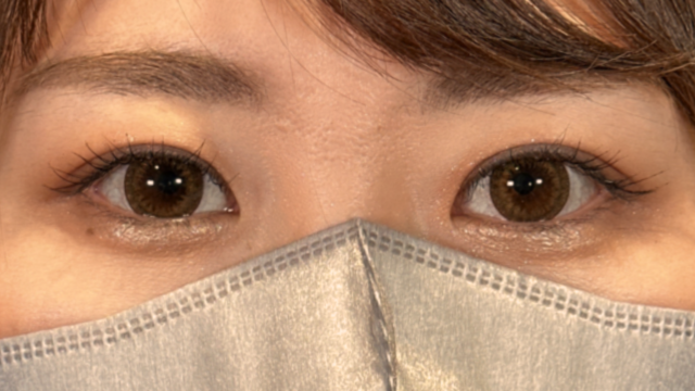 手术后的状态 其一