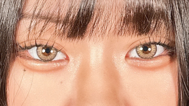 手术后的状态 其一