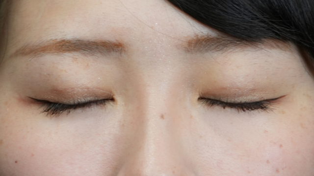 手术后的状态 其一