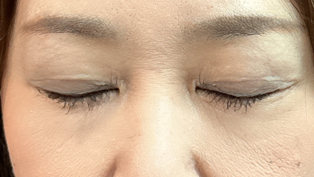 Postoperative Condition Part 1