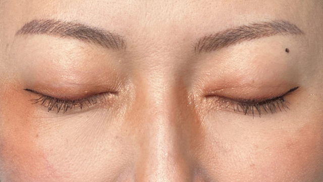 手术后的状态 其一