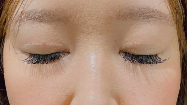 手术后的状态 其一