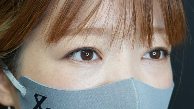 手术后的状态 其一