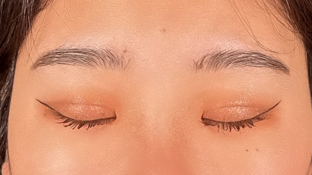 手术后的状态 其一