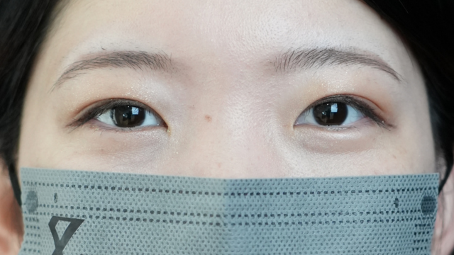 手术后的状态 其一