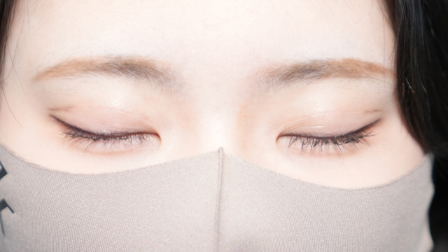 手术后的状态 其一